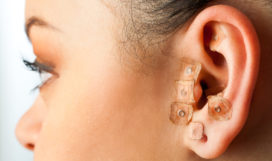 Macro close up of auriculotherapy on female ear.